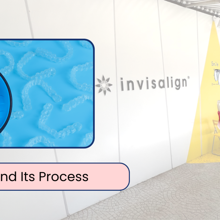 All About Invisalign and Its Process