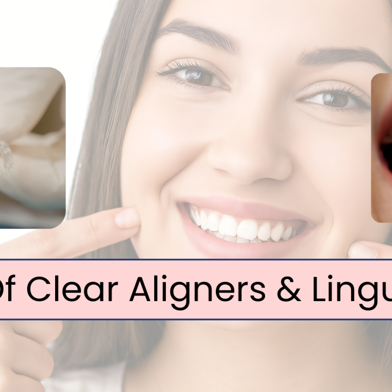 Benefits Of Clear Aligners & Lingual Braces