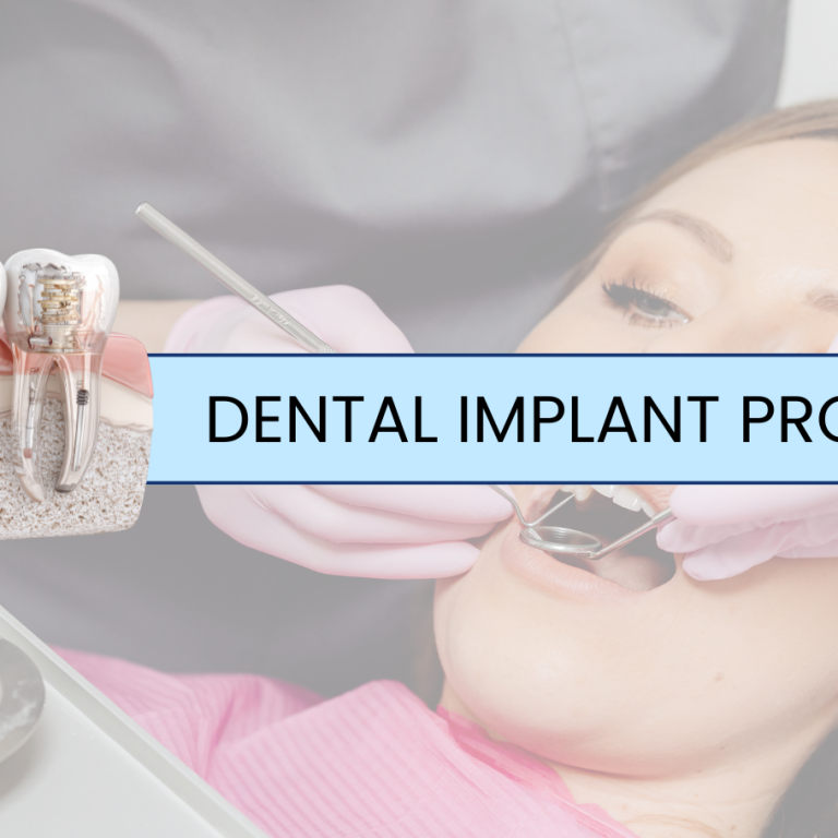 Dental Implant Procedure