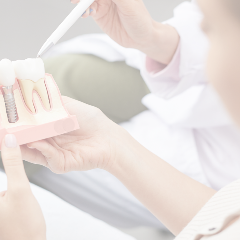 Dental Implants – The Best Way to Get Teeth Replacement