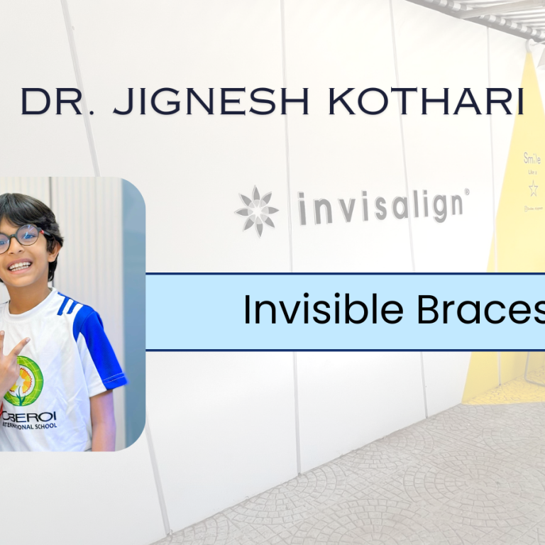 Invisible braces for kids