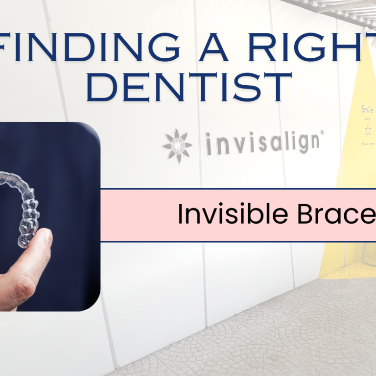 Invisible braces guide