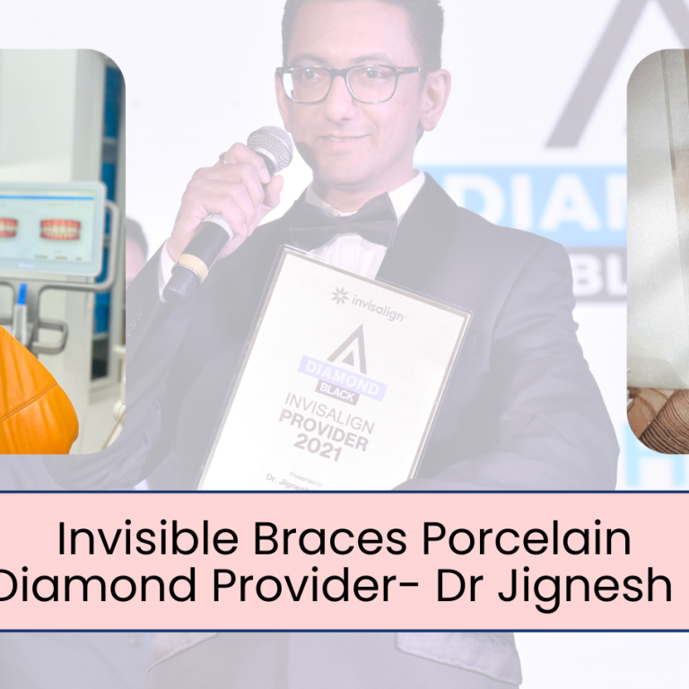Invisible braces porcelain