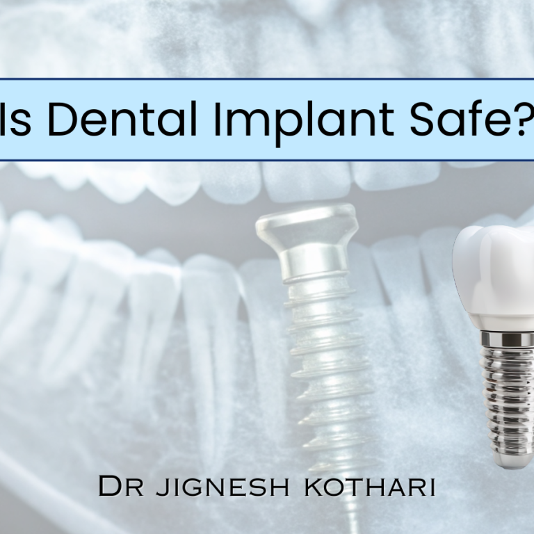 Is Dental implant a problem